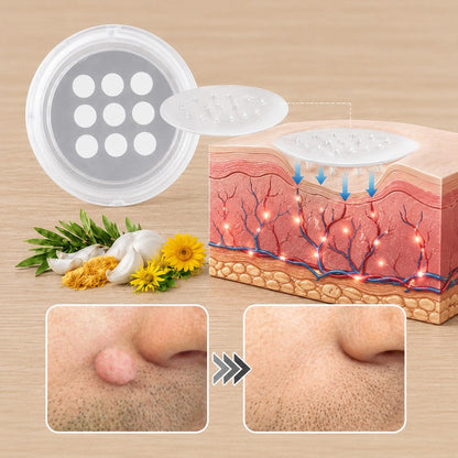 ✨PuraCure® 2 az 1-ben mikrotűs és hidrokolloid tapasz🍀 | Kiálló anyajegyek, aknék, lapos szemölcsök és bőrnövedékek eltávolítására | Segít csökkenteni a ráncokat, hegeket és bőrhibákat | Láthatatlan tapasz az arcra és testre