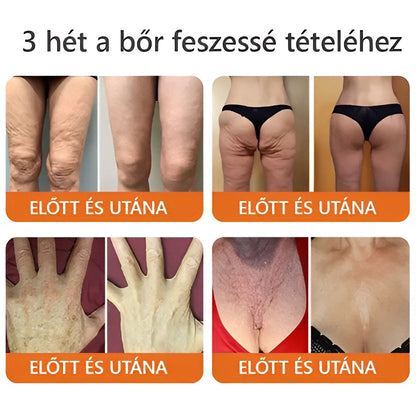 🧑‍⚕️ ZödVita® Méhméreg Bőr Helyreállító Krém 🔥🐝Magyar fejlesztés, magyarországi gyártás és szállítás