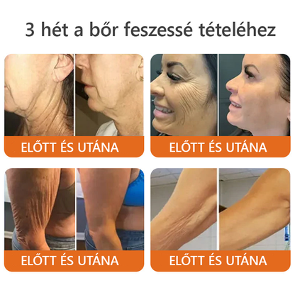 🧑‍⚕️ ZödVita® Méhméreg Bőr Helyreállító Krém 🔥🐝Magyar fejlesztés, magyarországi gyártás és szállítás