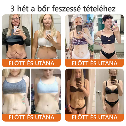 🧑‍⚕️ ZödVita® Méhméreg Bőr Helyreállító Krém 🔥🐝Magyar fejlesztés, magyarországi gyártás és szállítás