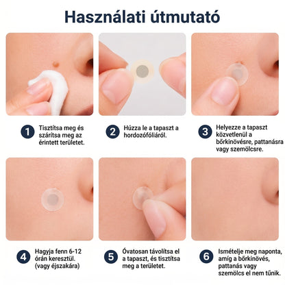 ✨PuraCure® 2 az 1-ben mikrotűs és hidrokolloid tapasz🍀 | Kiálló anyajegyek, aknék, lapos szemölcsök és bőrnövedékek eltávolítására | Segít csökkenteni a ráncokat, hegeket és bőrhibákat | Láthatatlan tapasz az arcra és testre