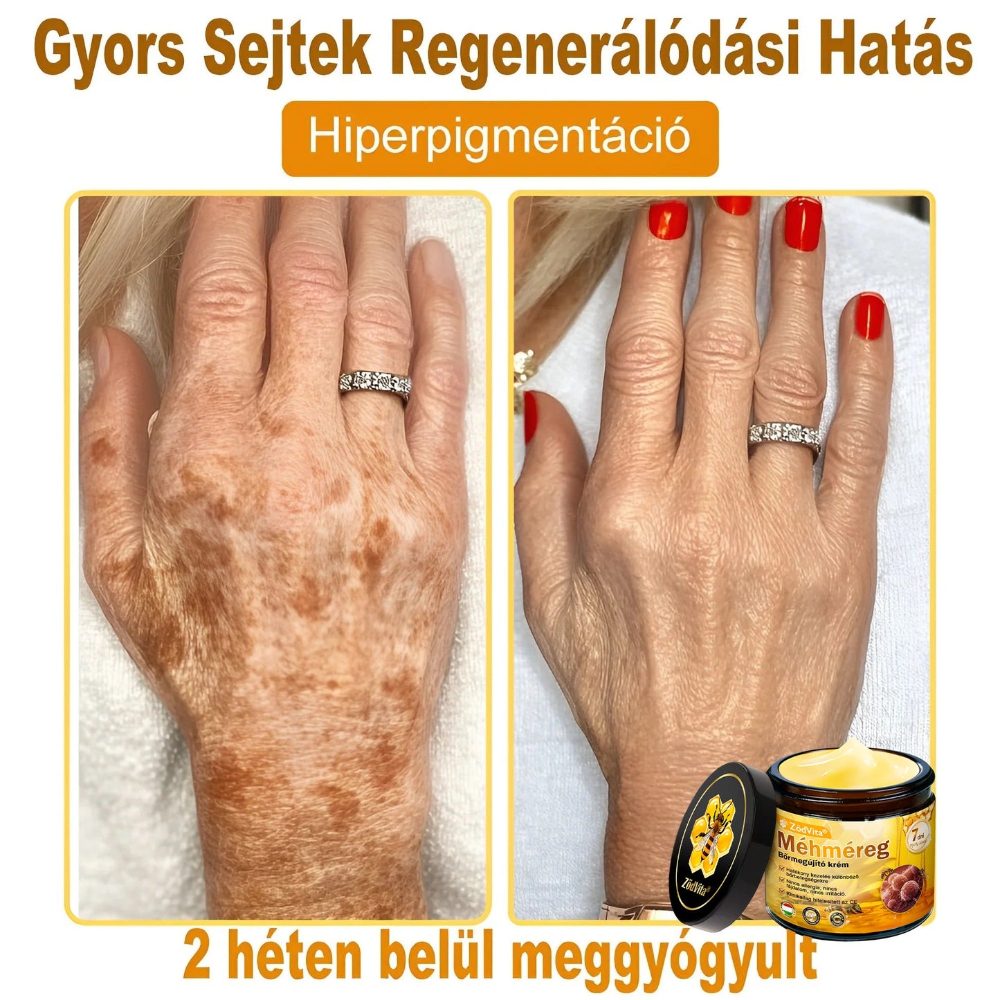 🧑‍⚕️ ZödVita® Méhméreg Bőr Helyreállító Krém 🔥🐝Magyar fejlesztés, magyarországi gyártás és szállítás
