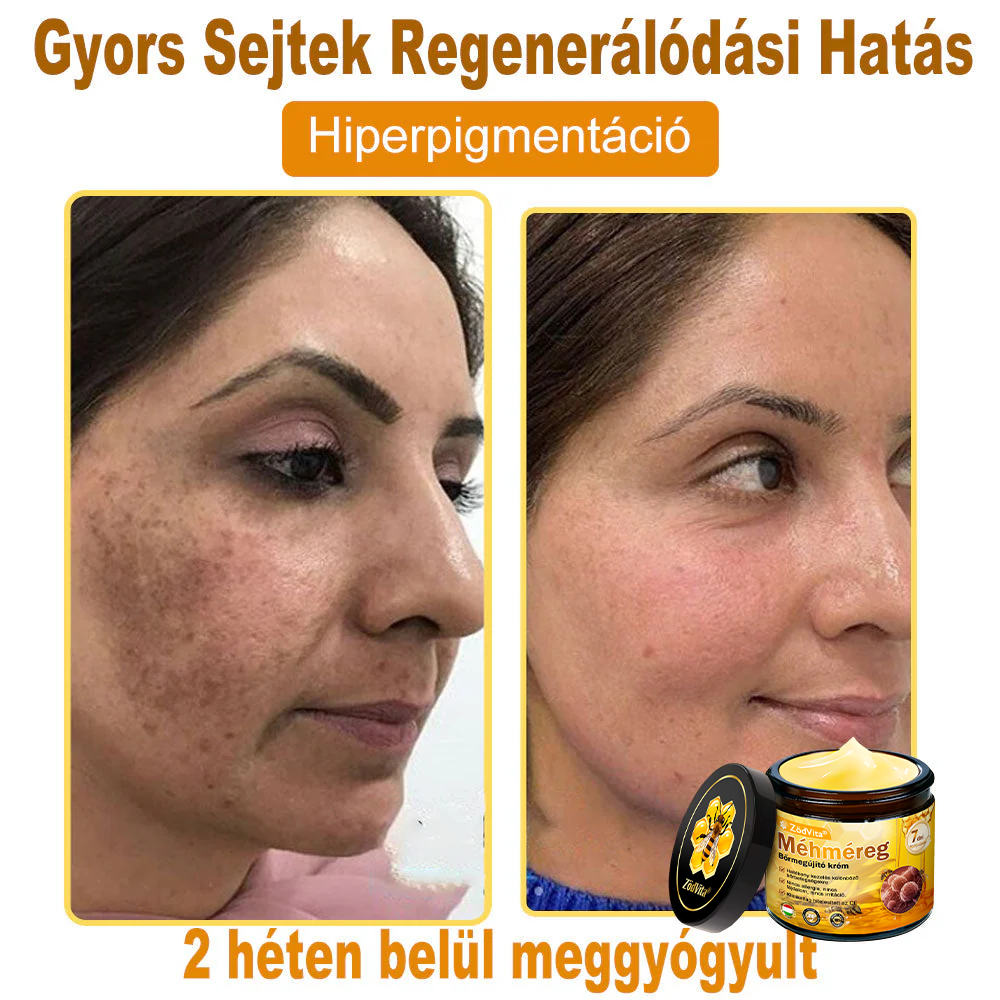 🧑‍⚕️ ZödVita® Méhméreg Bőr Helyreállító Krém 🔥🐝Magyar fejlesztés, magyarországi gyártás és szállítás